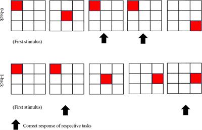 Is There Any Relationship Between Biochemical Indices and Anthropometric Measurements With Dorsolateral Prefrontal Cortex Activation Among Older Adults With Mild Cognitive Impairment?